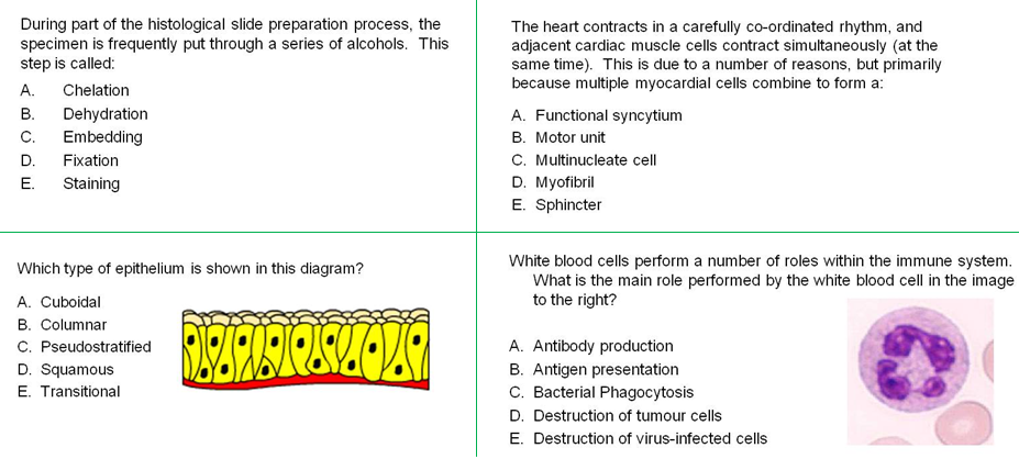 Examples of MCQs